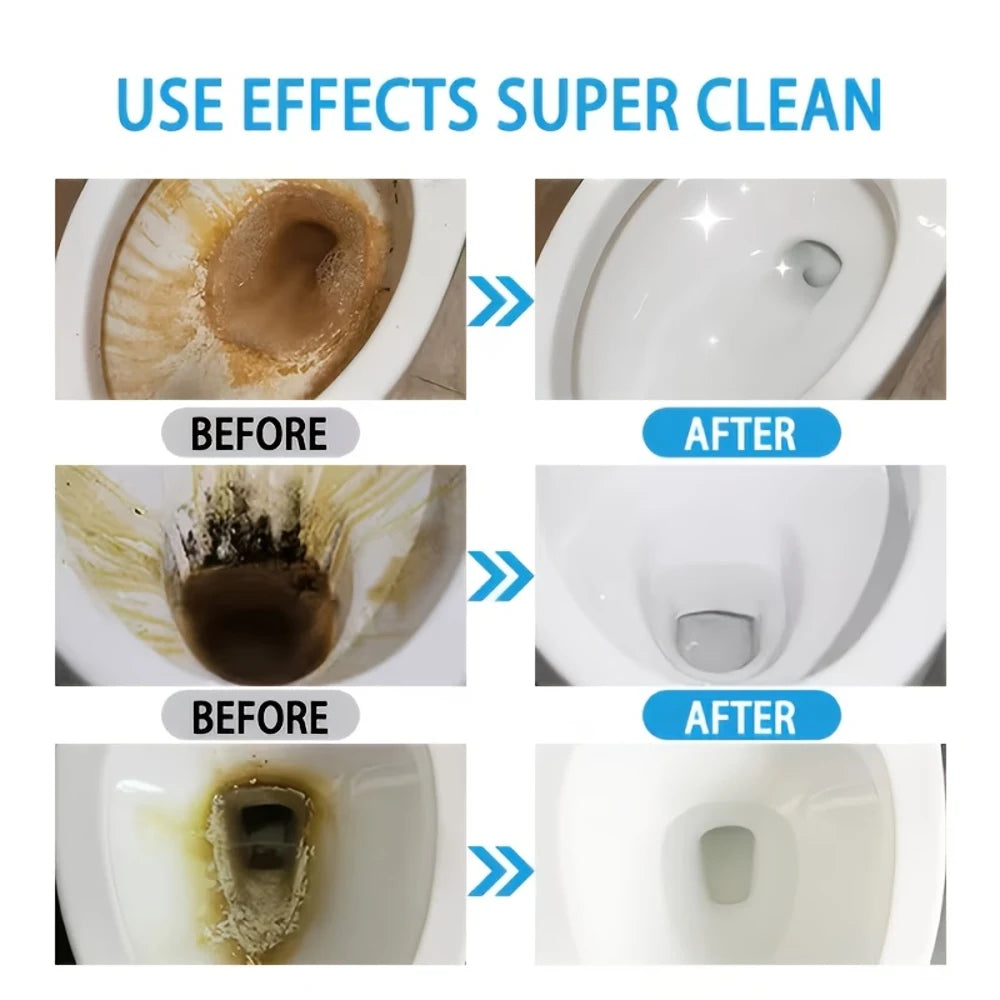 Toilet Cleaner — Deep Cleaning | Removes Stains and Limescale | Keeps Toilet Clean and Shiny | Easy to Use, Helps with Toilet Un