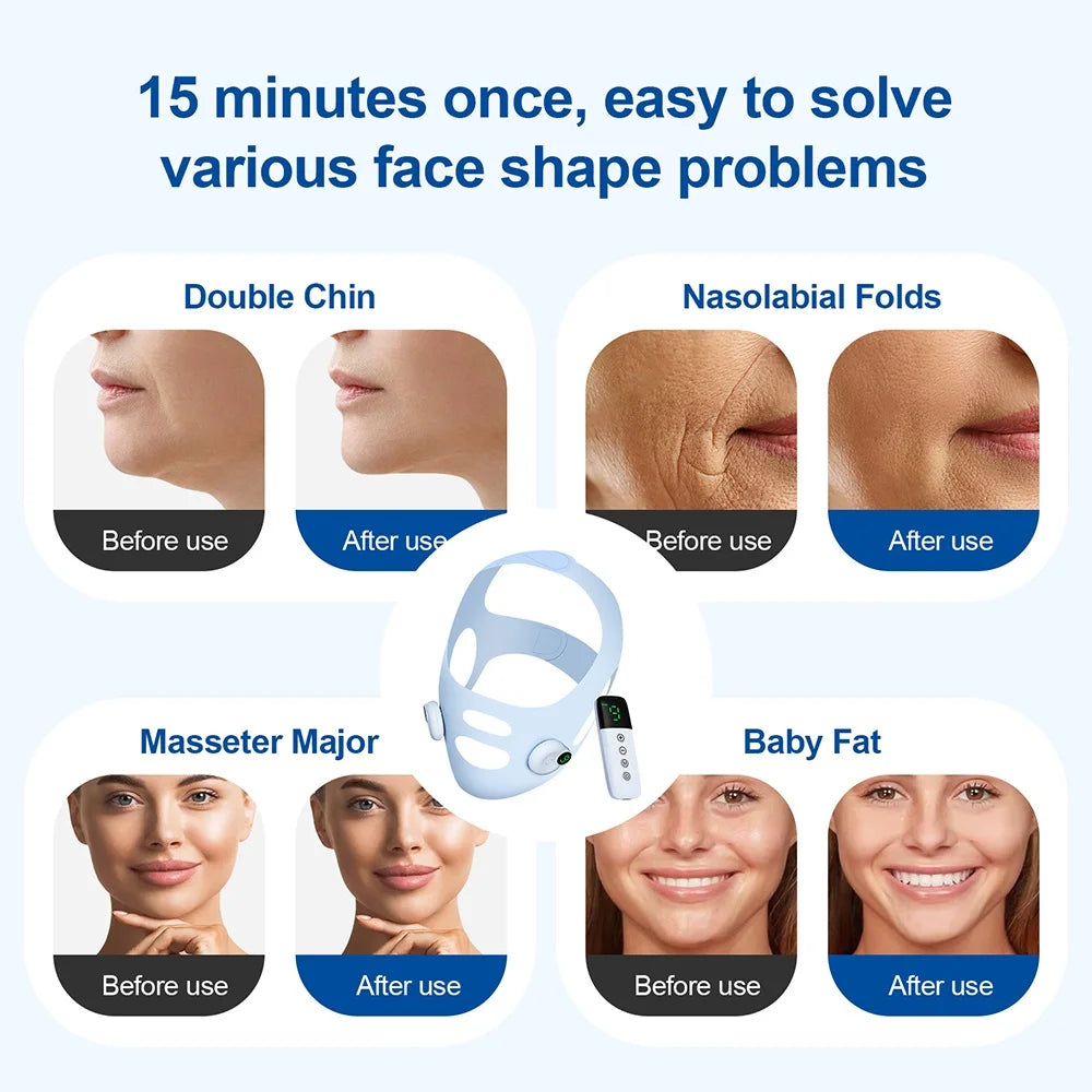 Electric Face Slimming Bandage V Line Chin Strap Facial Shaping Massager Edema Removal Mask V Line Lift Up Belt